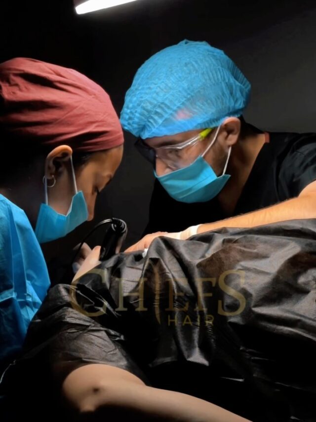 The Best Hair Transplant Center