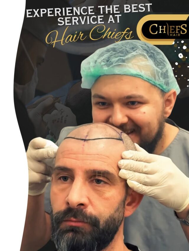 Hair Transplant in Turkey Best