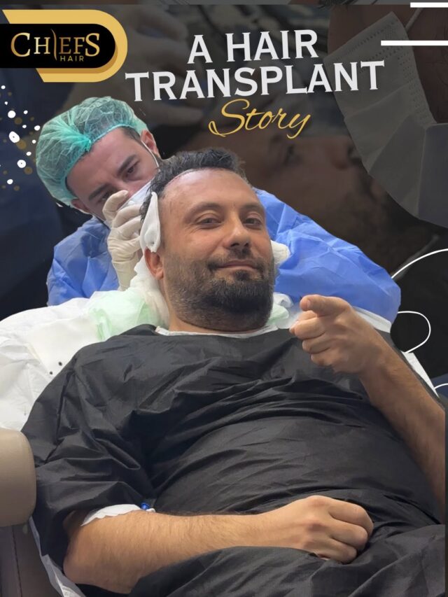 hair transplant adventure is with you.